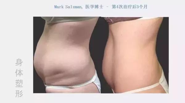 最新减肥医，小巷深处的瘦身奇迹揭秘